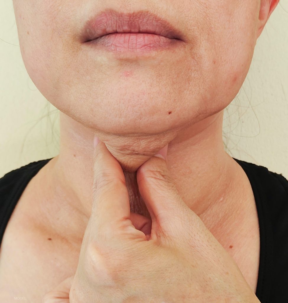 40 year old woman holding extra skin under her neck between her fingers (model)