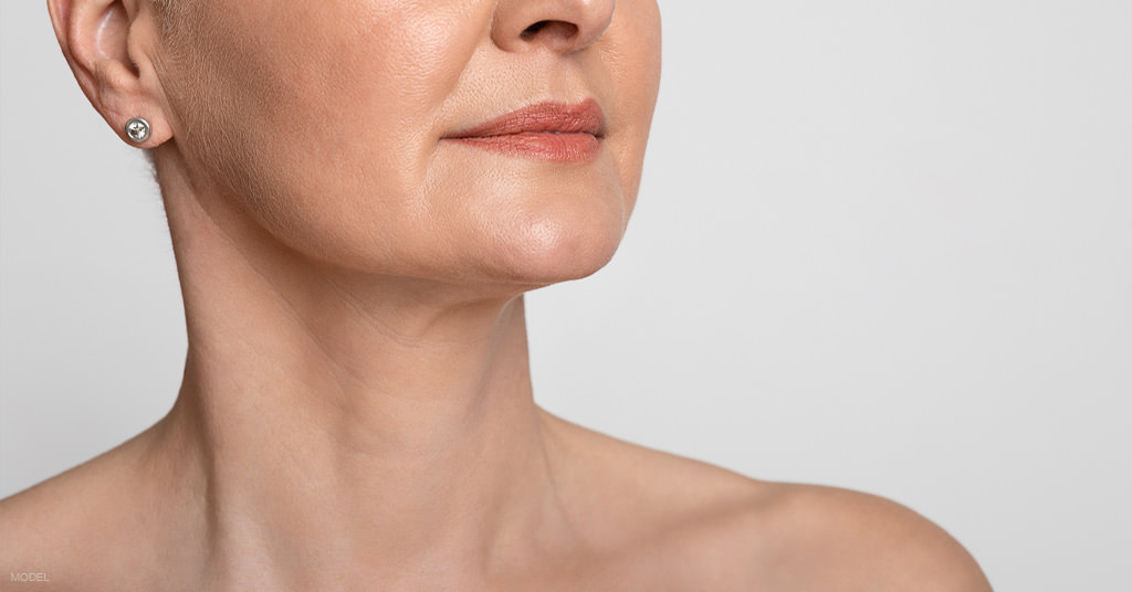 Close-up of a woman's face, neck, and shoulders showing visible skin laxity beneath the chin (model)