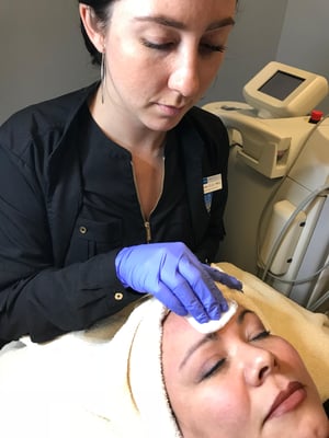 Chemical peel treatment