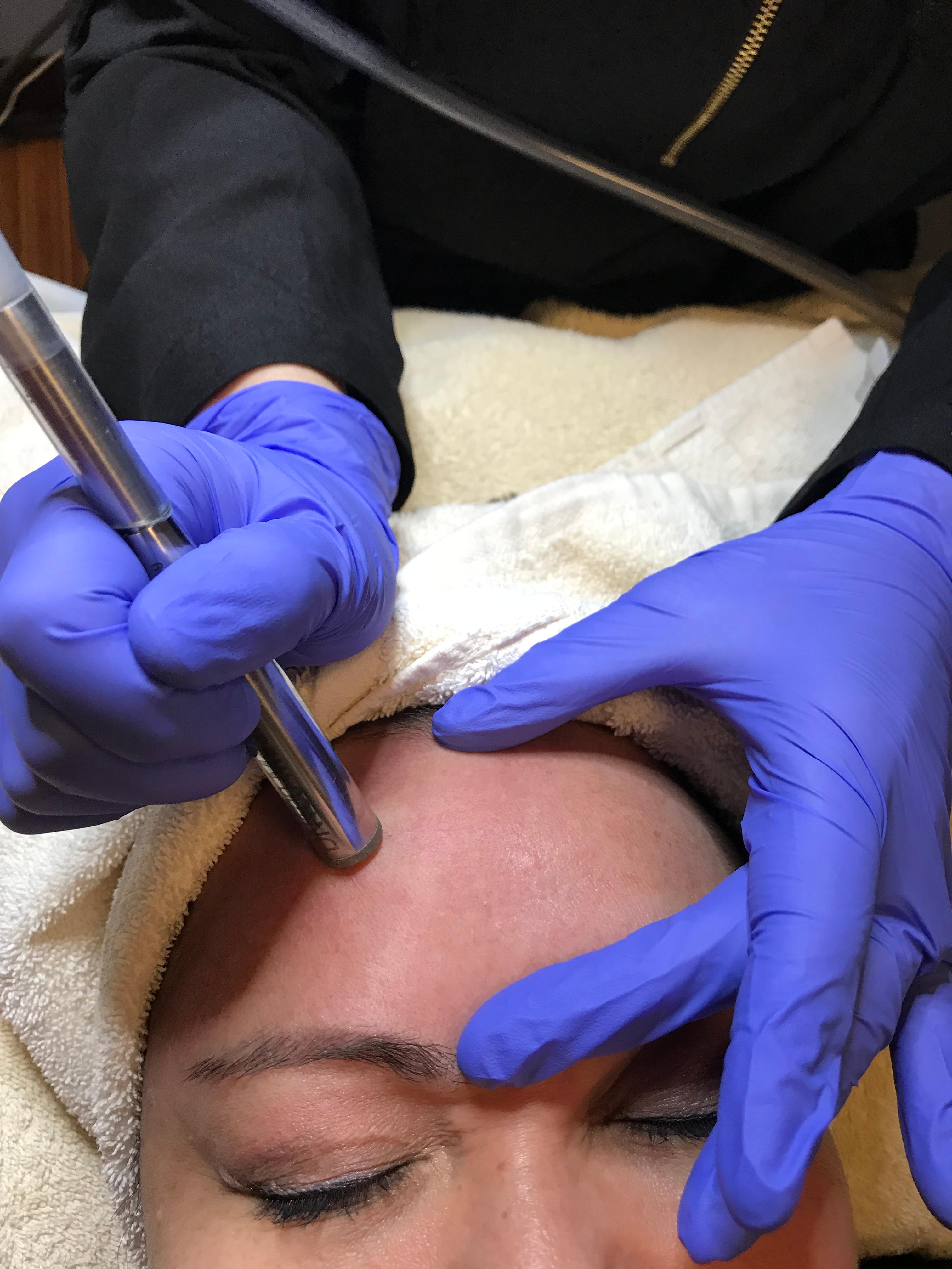 diamondtome microdermabrasion near me