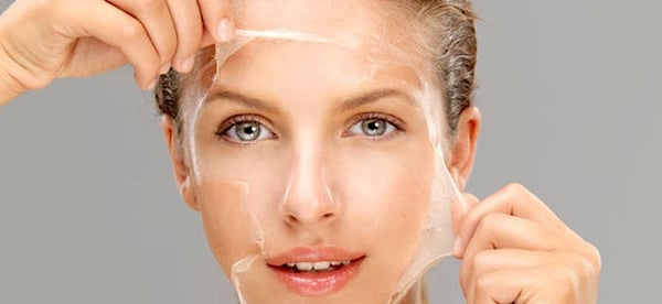Glycolic Peel