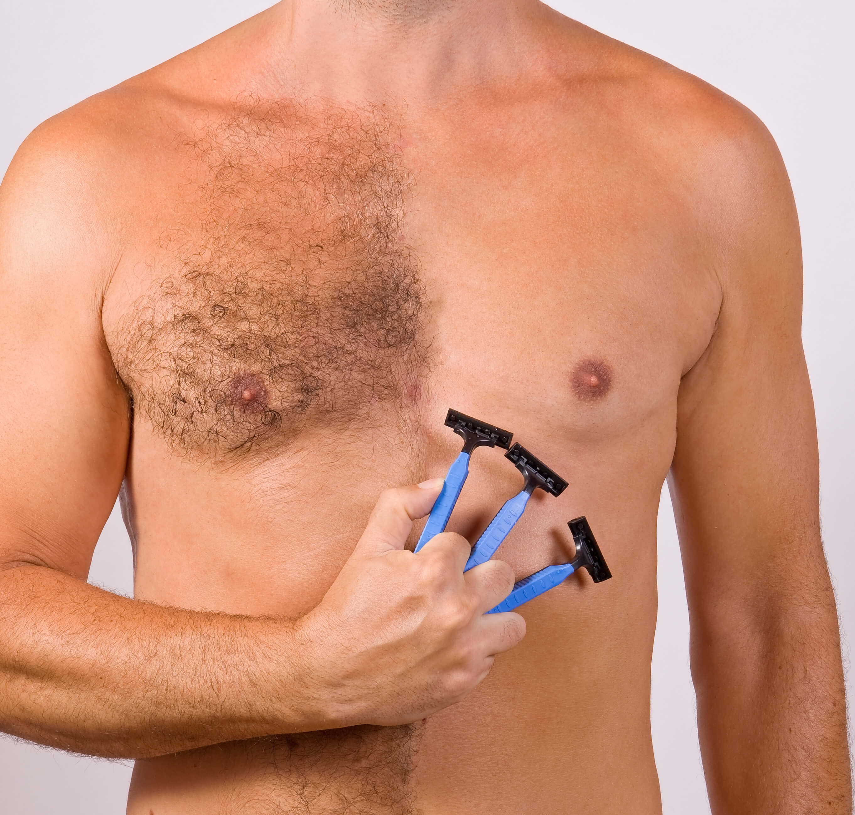 Laser Hair Removal for Men