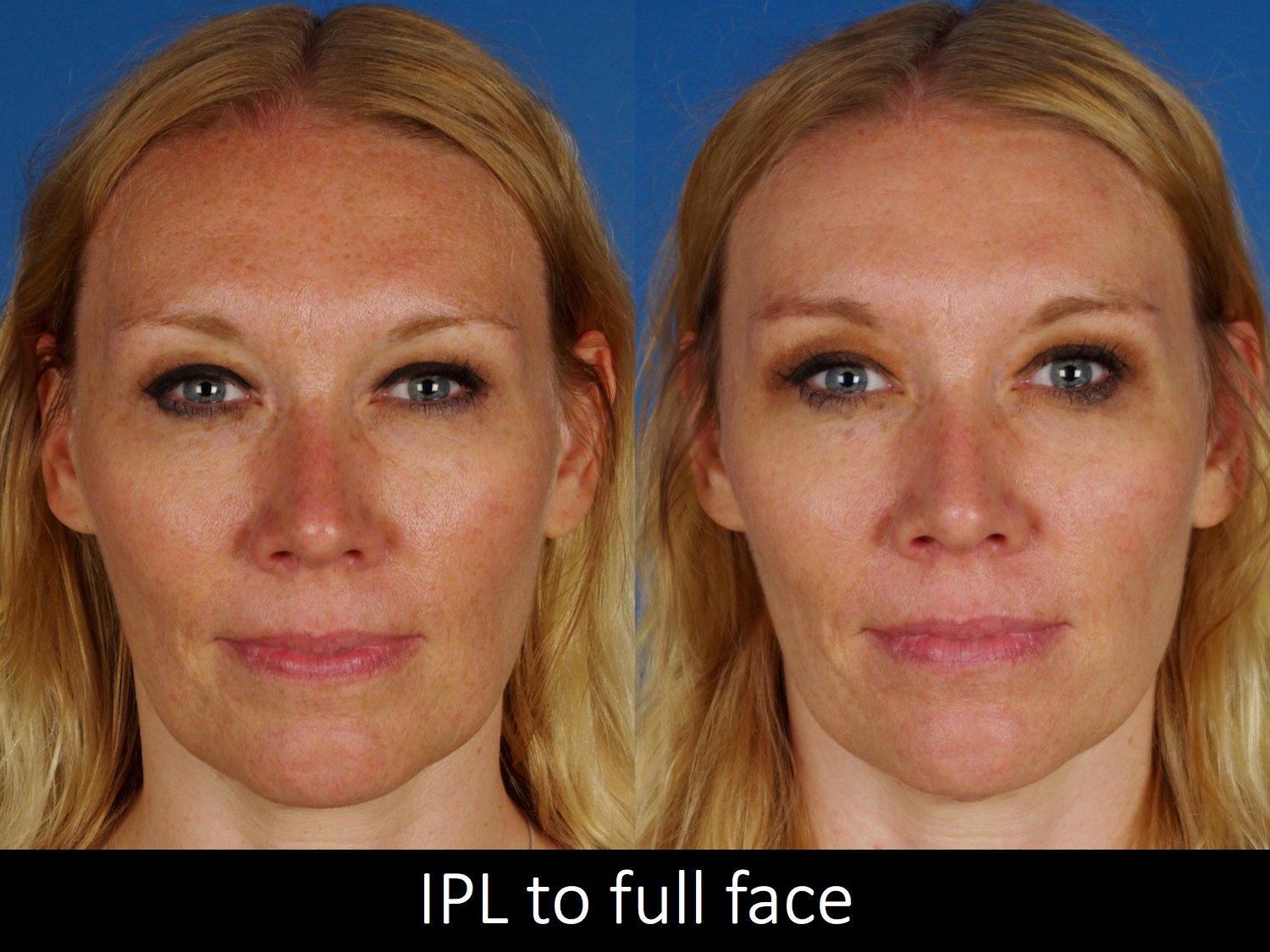 facial treatments-114-1 of 1