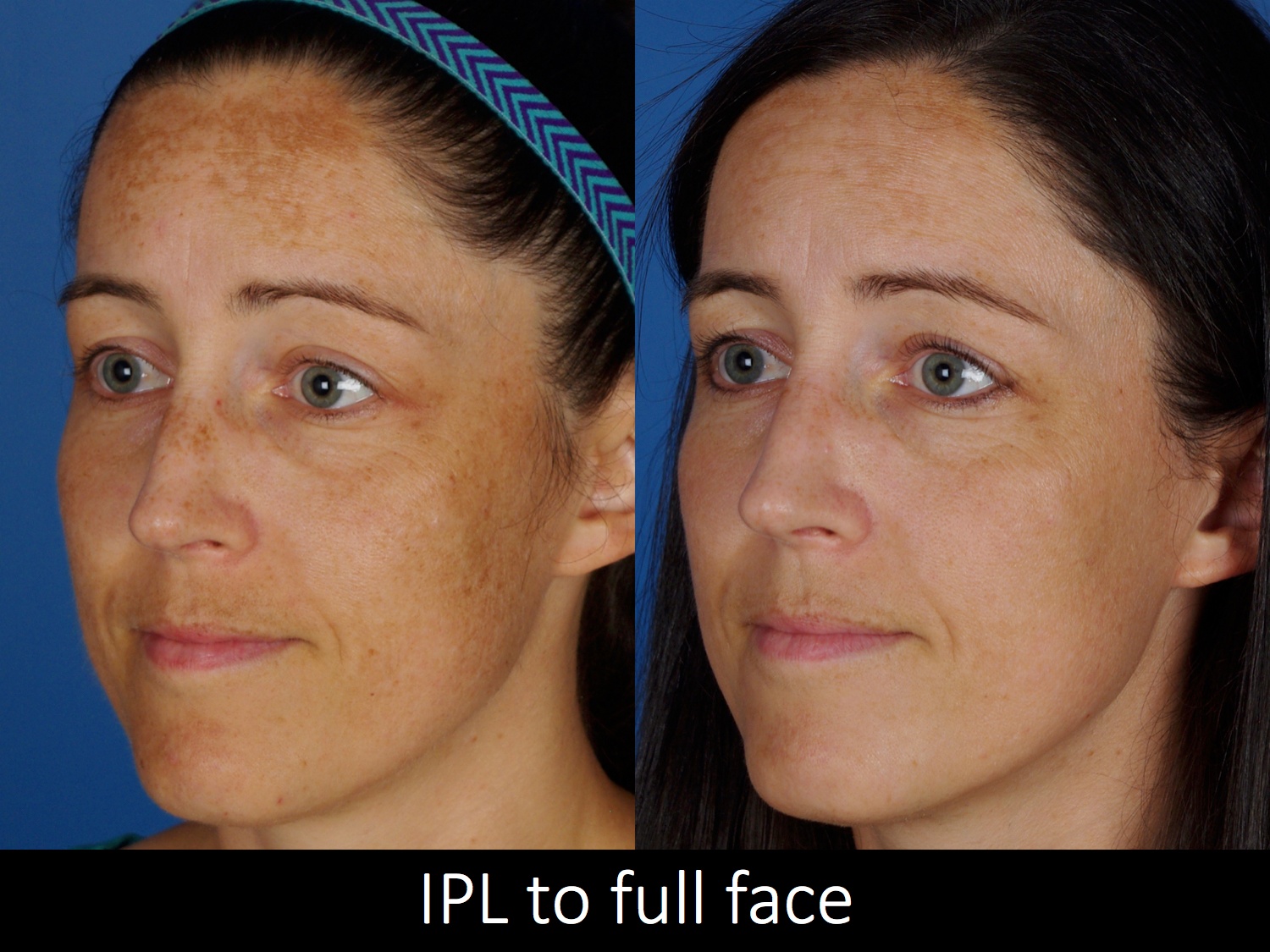 facial treatments-113-1 of 1