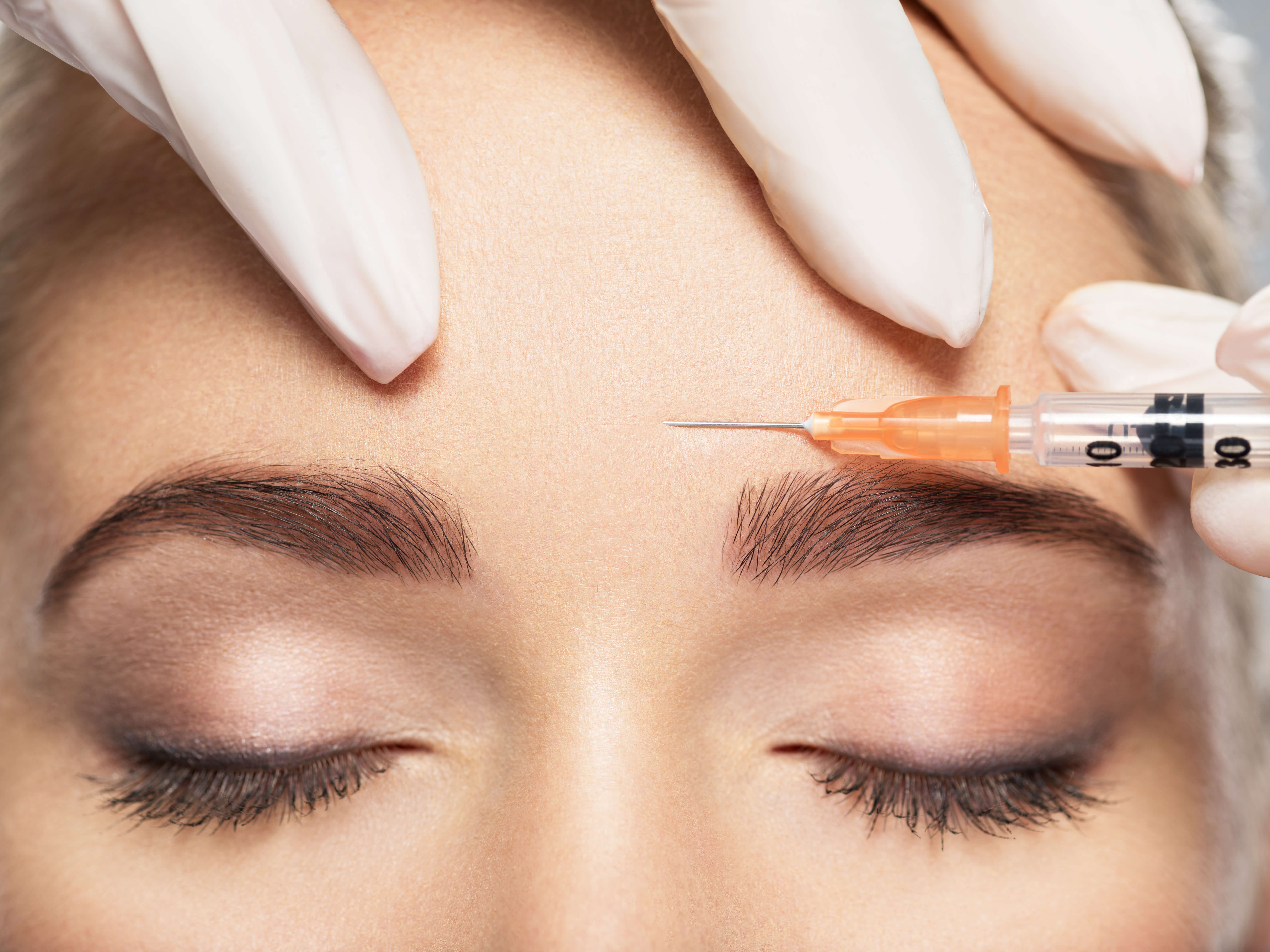What is the Difference Between Botox and Dysport?