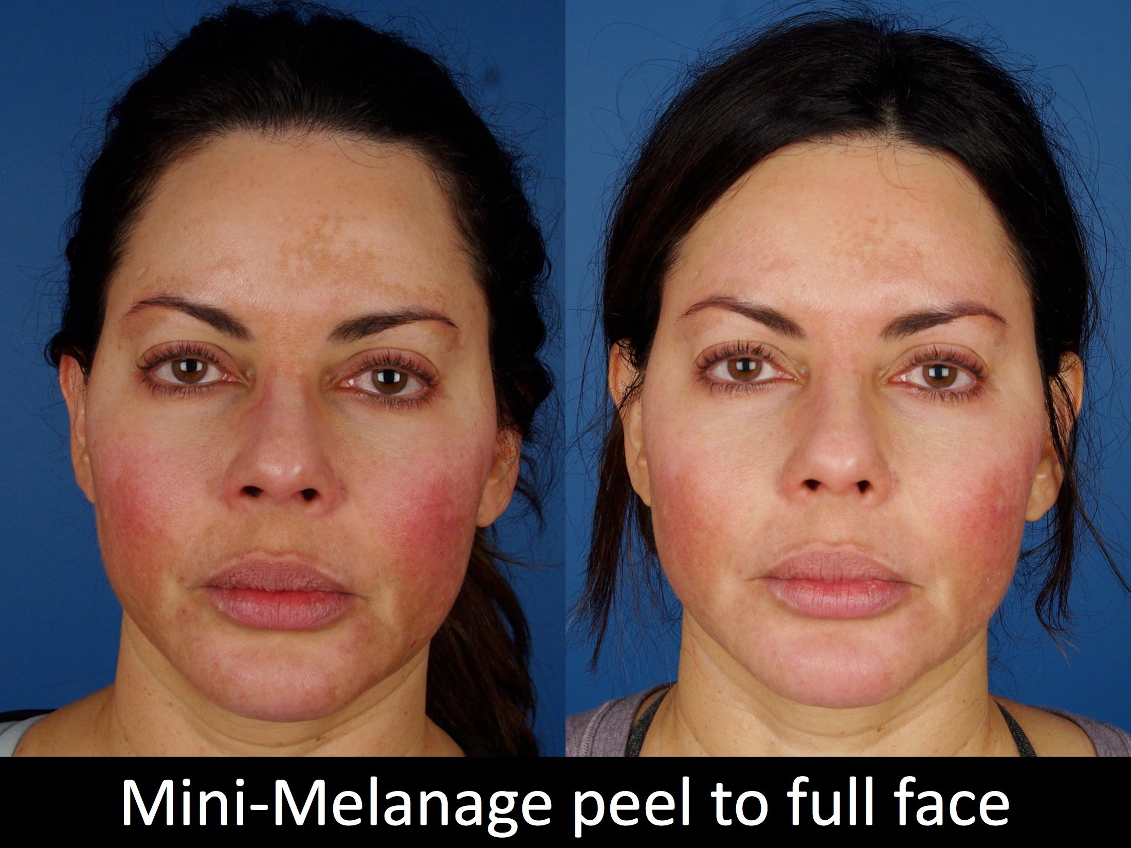 facial treatments-120-1 of 5