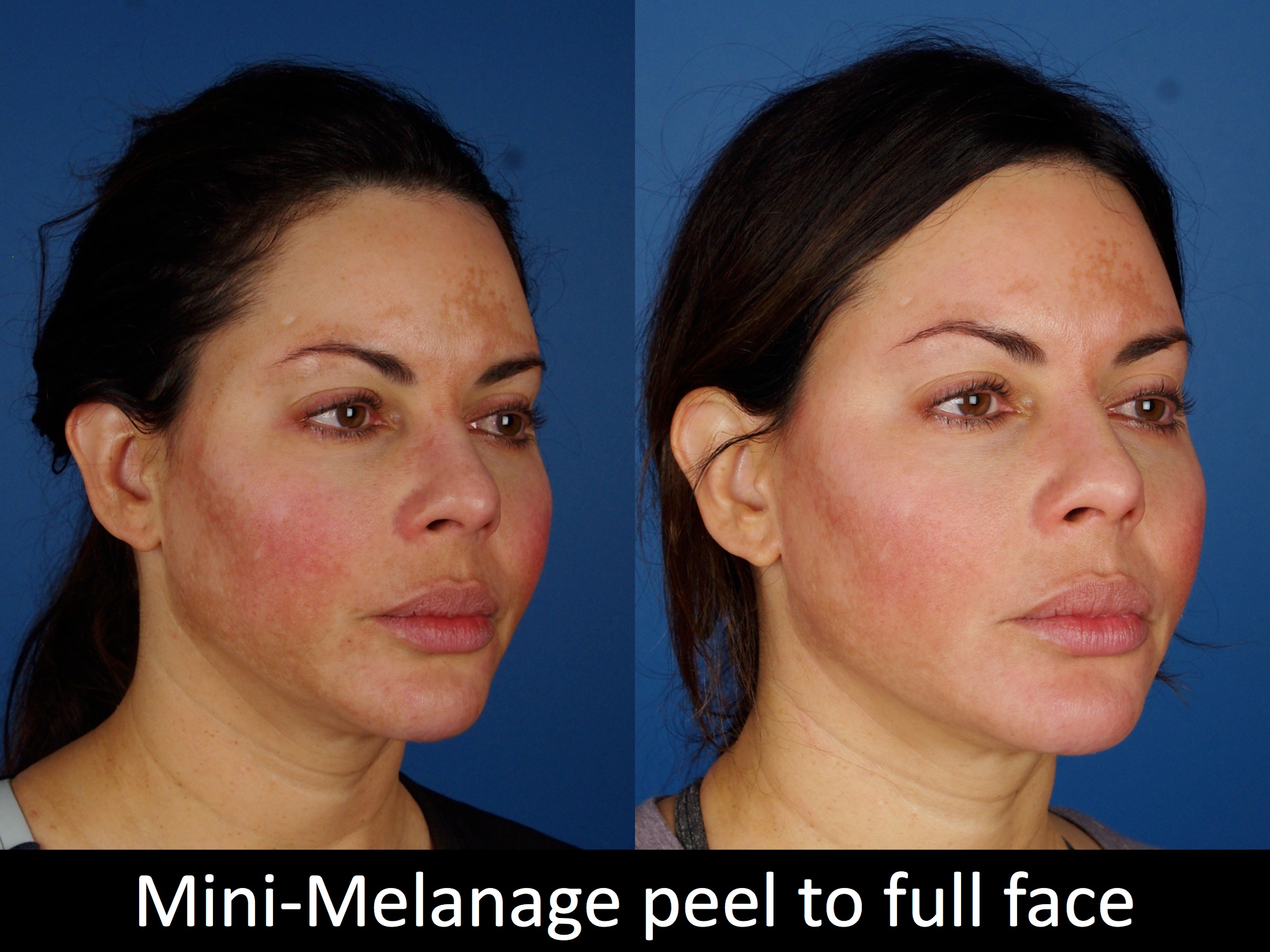 facial treatments-120-4 of 5