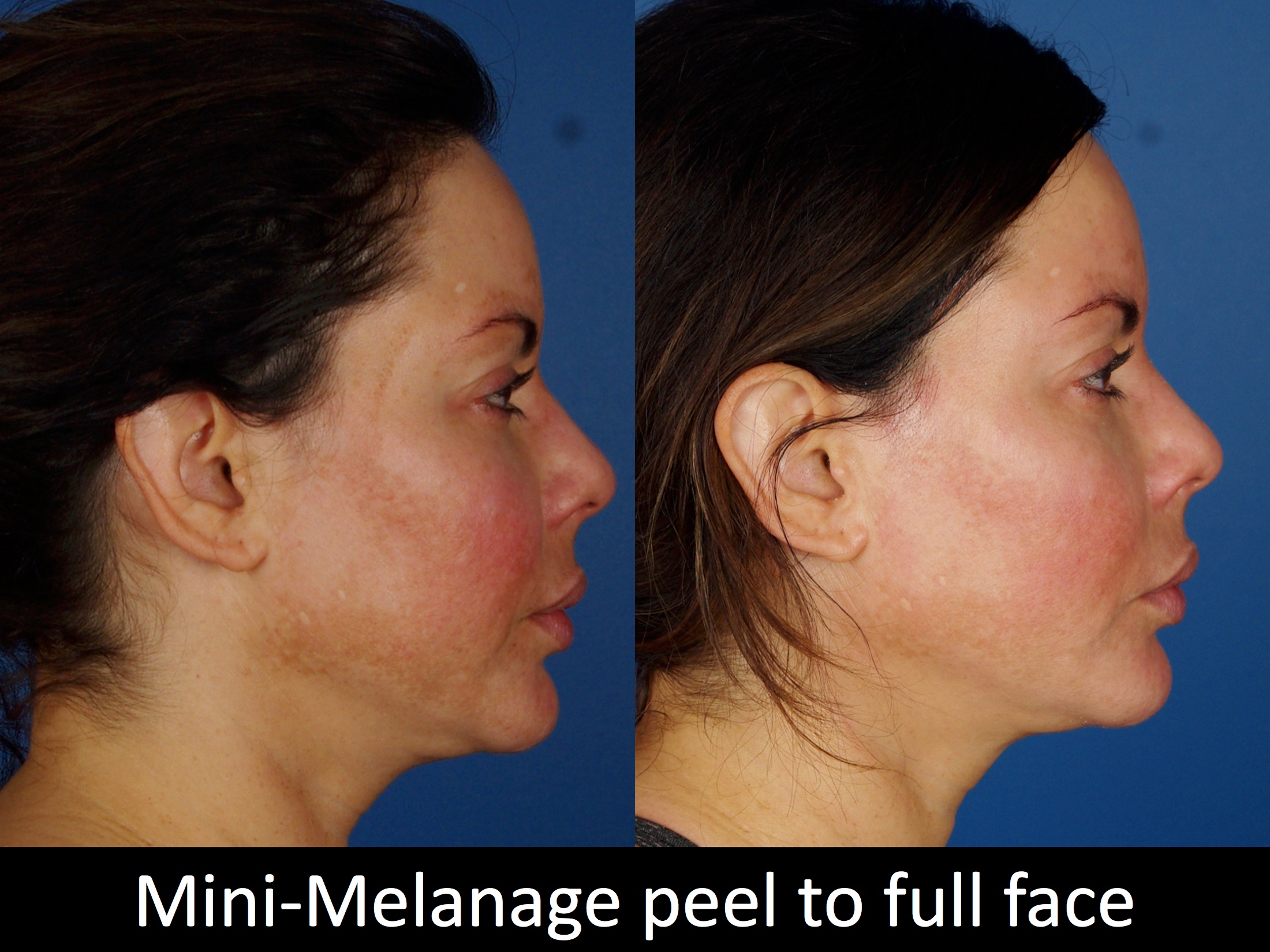 facial treatments-120-5 of 5