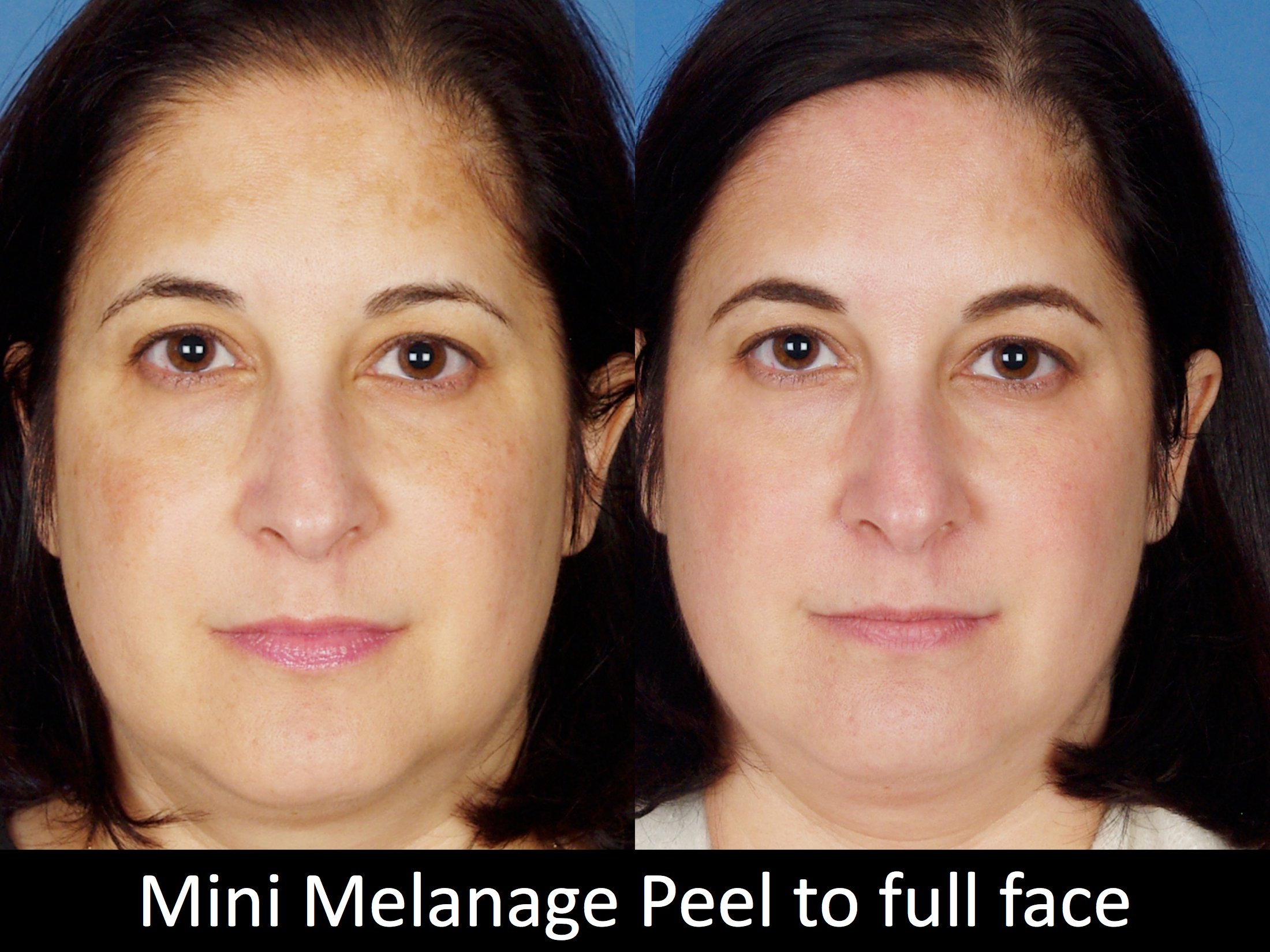 facial treatments-126-3 of 3*