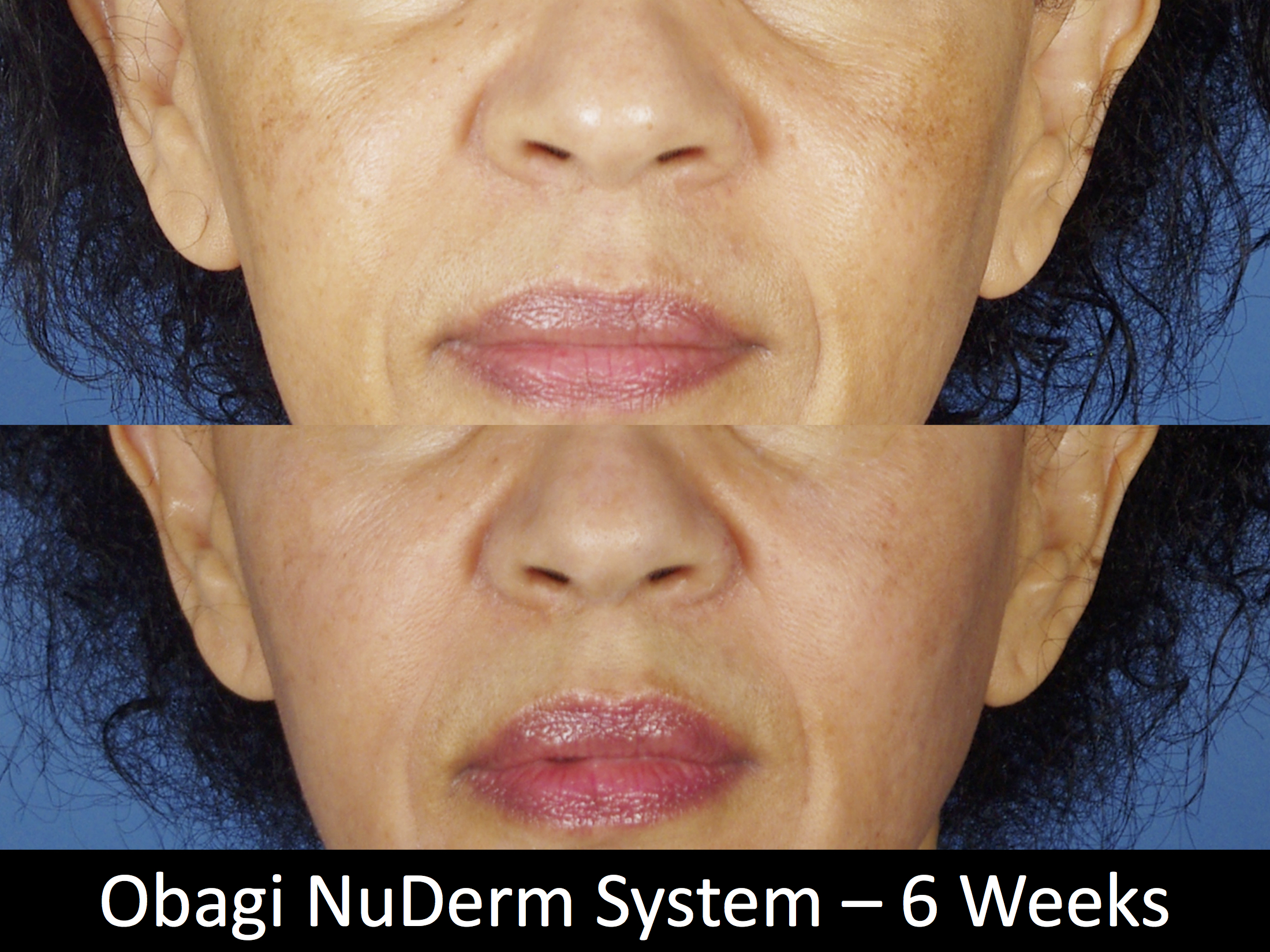 facial treatments-127-1 of 2*