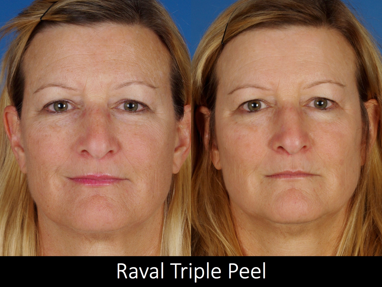 facial treatments-117-1 of 2