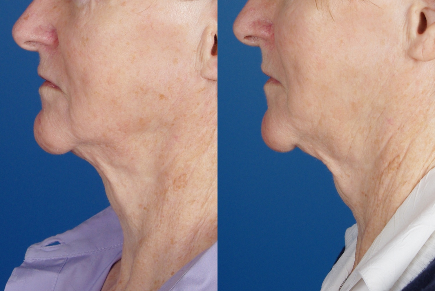 facial treatments-105-2 of 2