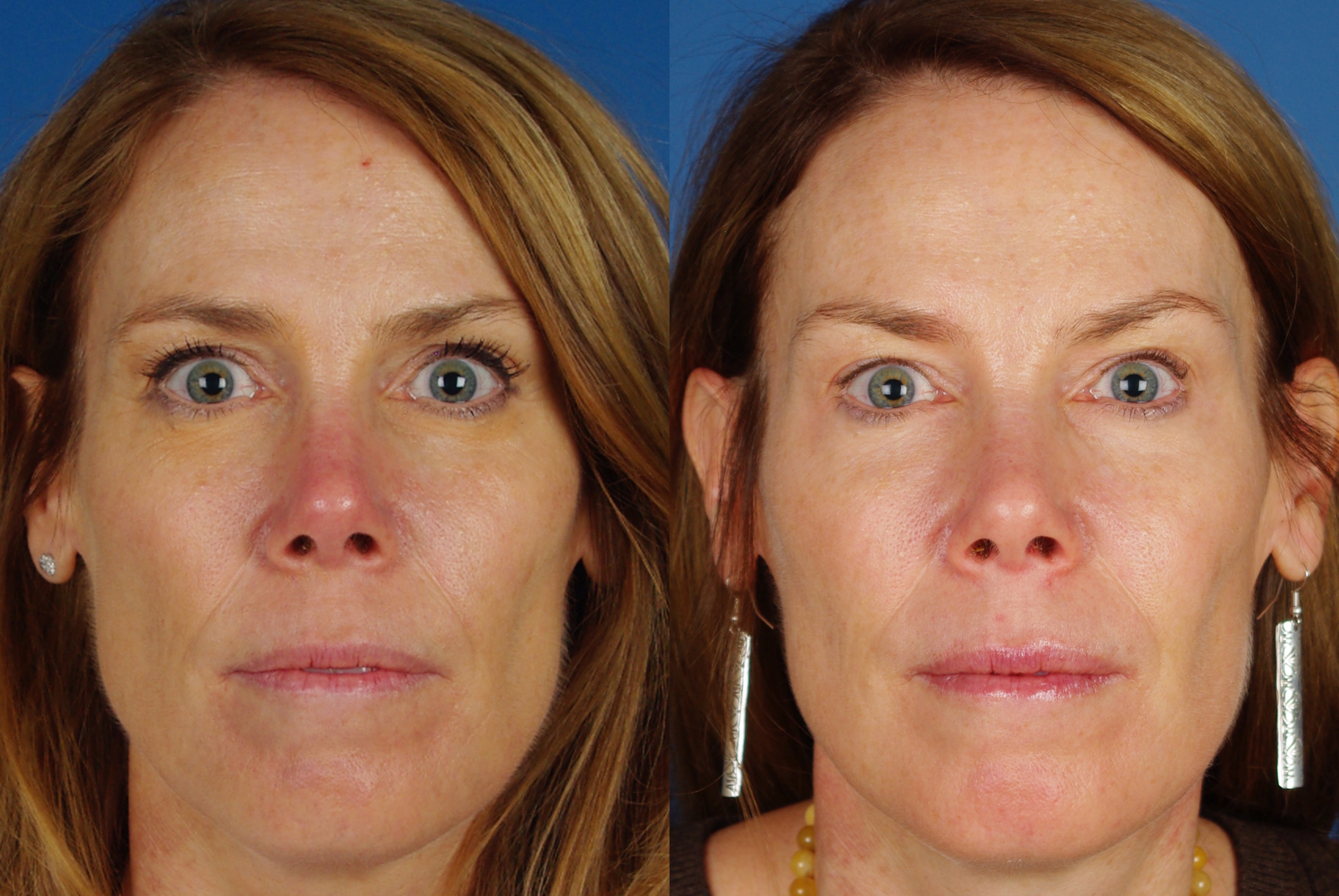 facial treatments-110-1 of 3*