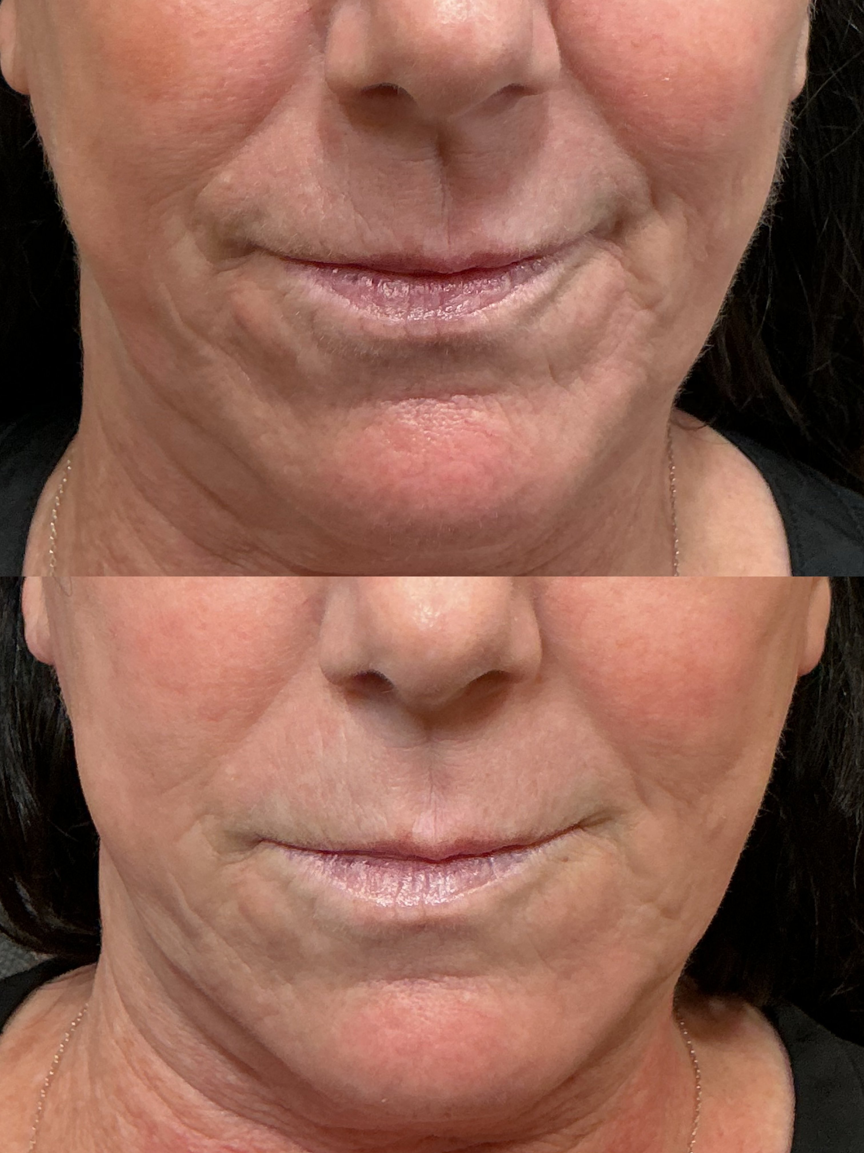 filler MLF, PJ and pro fx w Kayla (2)