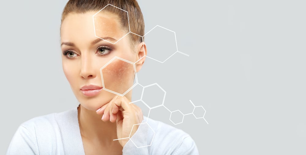 What is Hydroquinone?