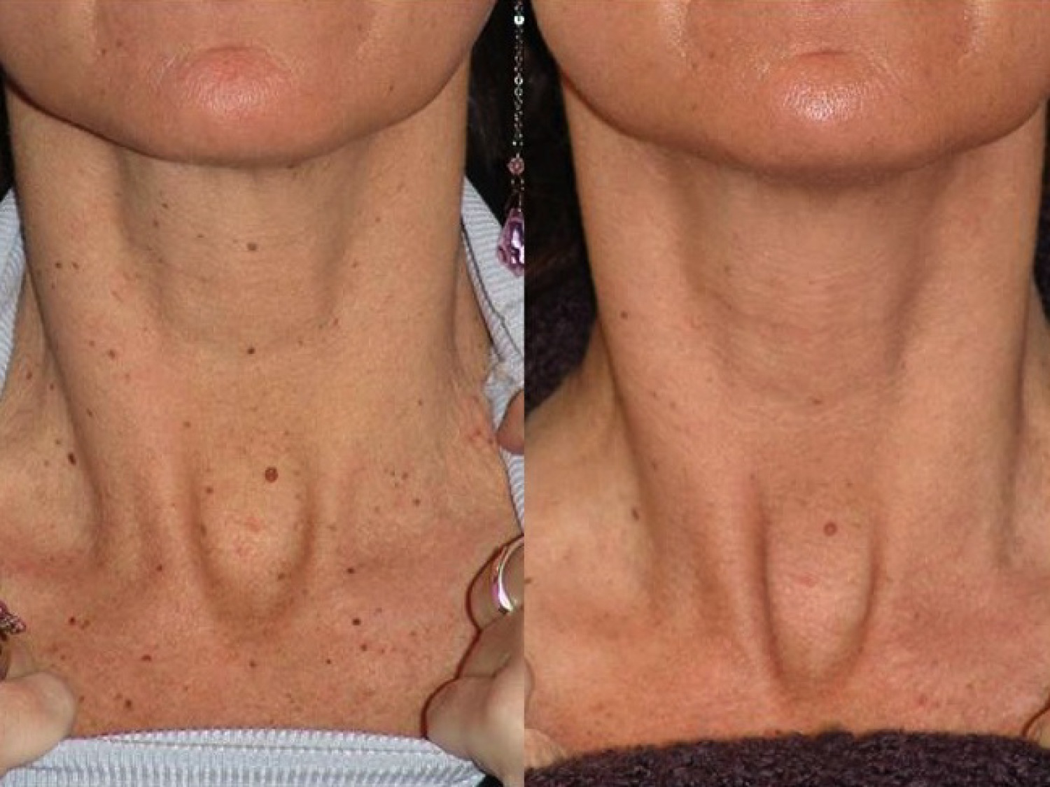 facial treatments-108-1 of 1