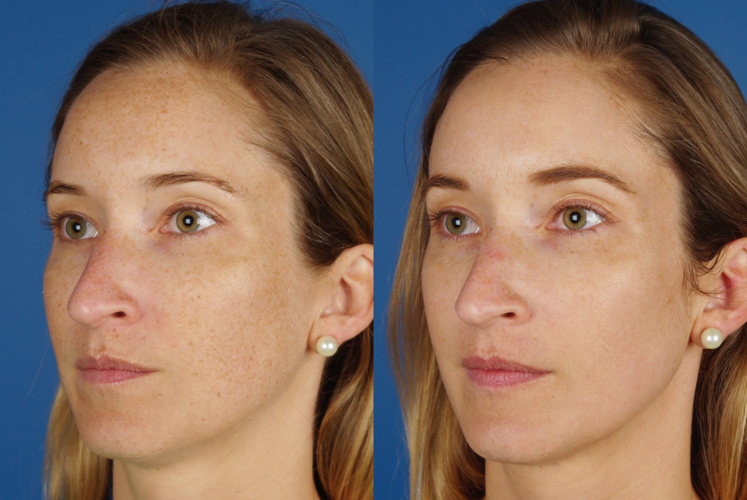 facial treatments-101-2 of 3