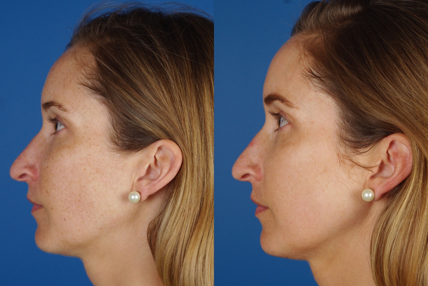 facial treatments-101-3 of 3