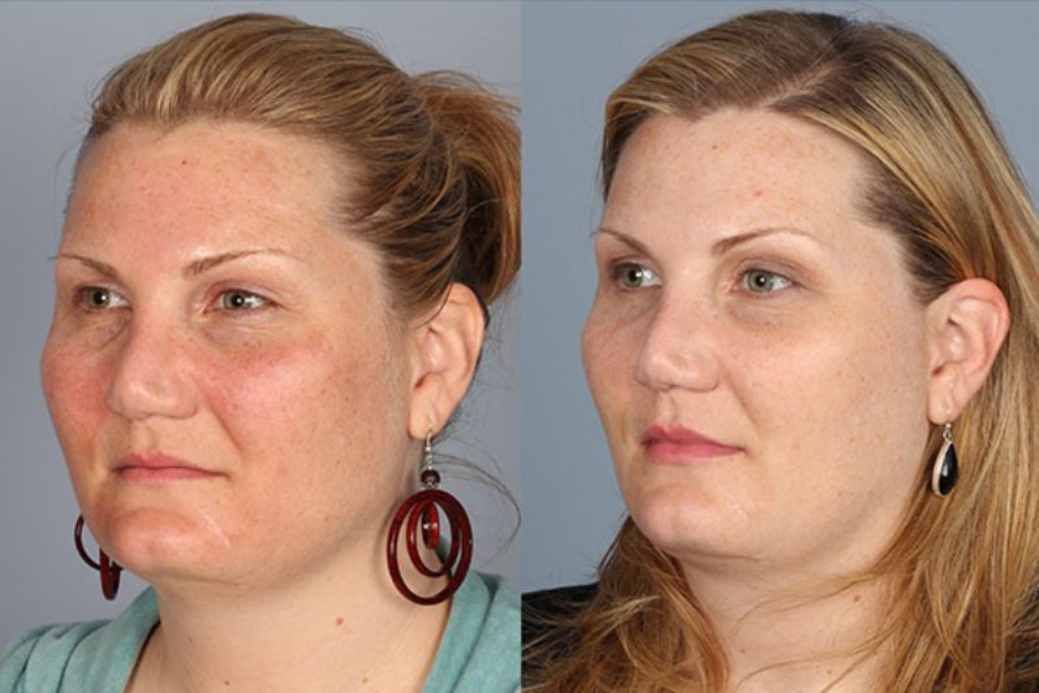 facial treatments-105-1 of 1